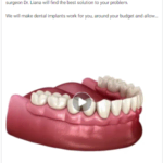 Liana-Stein-DDS-Dental-Implants